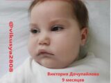 Девятимесячной малышки Виктории Дочупайловой из Павлодара срочно нужна финансовая помощь