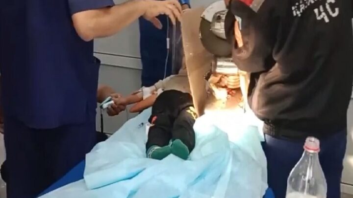 Рука 3-летнего ребенка попала в электромясорубку