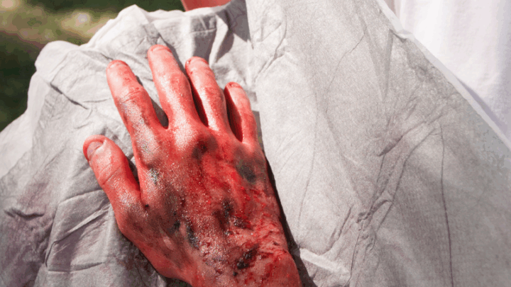 Серьезные ожоги тела получили пострадавшие в пожаре в Туркестанской области