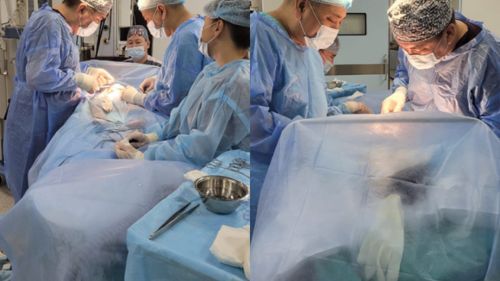 Крупную опухоль у 4-летнего ребенка удалили врачи в Шымкенте