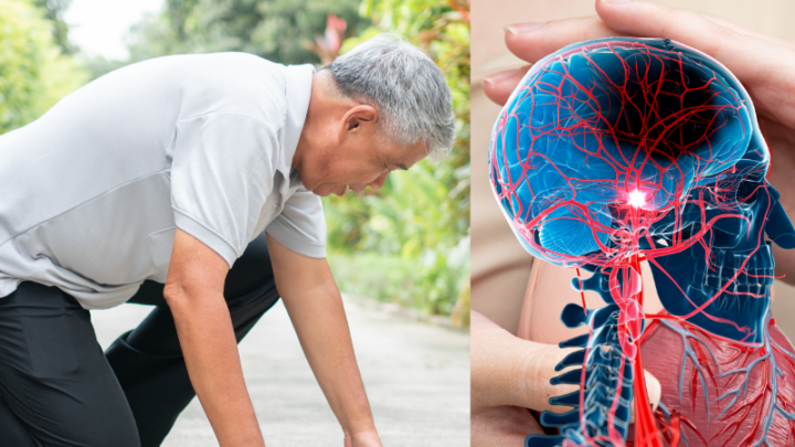 О важных признаках инсульта напомнил врач Шымкента