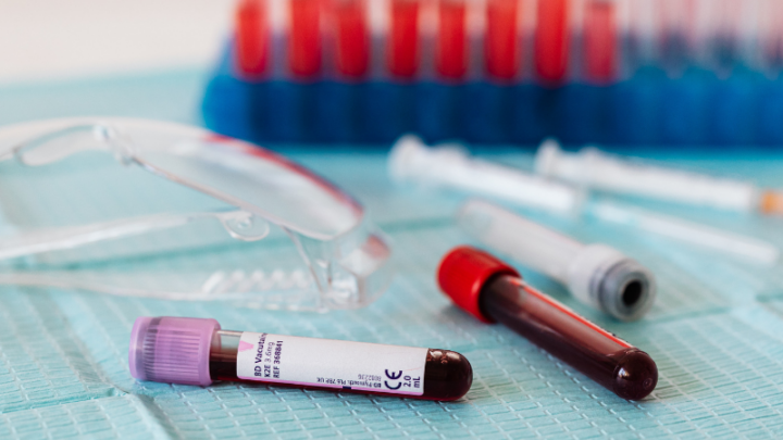 Мужчина с диагнозом «сибирская язва» проходит лечение в Шымкенте