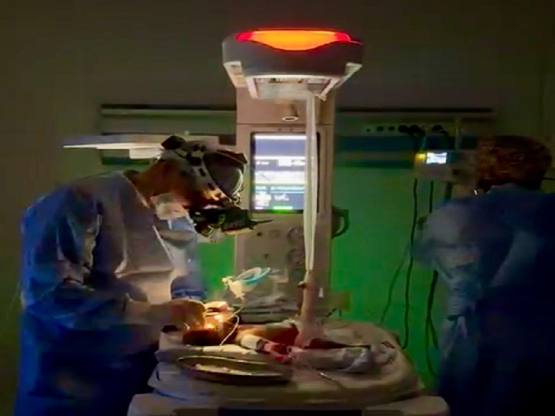 Новорожденному весом 650 гр провели сложнейшую операцию в Шымкенте